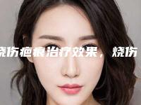 烧伤疤痕治疗效果，烧伤疤痕能否修复
