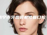 南宁市牙齿裂痕修复口腔医生上榜名单有名的口碑反馈超好-南宁市牙齿裂痕修复医生实力不容小觑