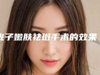 光子嫩肤祛斑手术的效果及优点