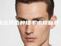 商丘牙齿种植手术修复对以后生育有影响吗