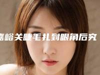 嘉峪关睫毛扎到眼角后究竟能维持多久