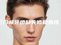 三门峡牙齿缺失修复拆线后怎么护理