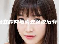 杨立峰肉毒素去额纹后有什么危害吗