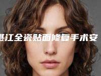 湛江全瓷贴面修复手术安全么