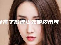 女孩子做埋线双眼皮后可以保持几年时间(眼皮埋线的双眼皮能保持多久)
