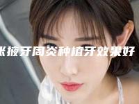 张掖牙周炎种植牙效果好不好,做多少次才有效果