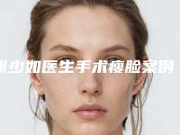 张少如医生手术瘦脸案例-价格(价目)表2025详情一览
