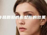 许昌唇裂畸形整形的效果真的那么神奇