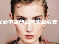辽源市痘印变成黑色素去除整形医院(辽源张庆国医疗美容诊所品牌连锁技术_设备领先)