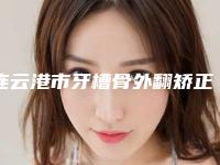 连云港市牙槽骨外翻矫正医院上榜清单前十佳权威大盘点(连云港市牙槽骨外翻矫正口腔医院含价格一览表)