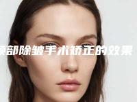 颈部除皱手术矫正的效果好不好-颈部除皱手术术后效果能够保持多久呢